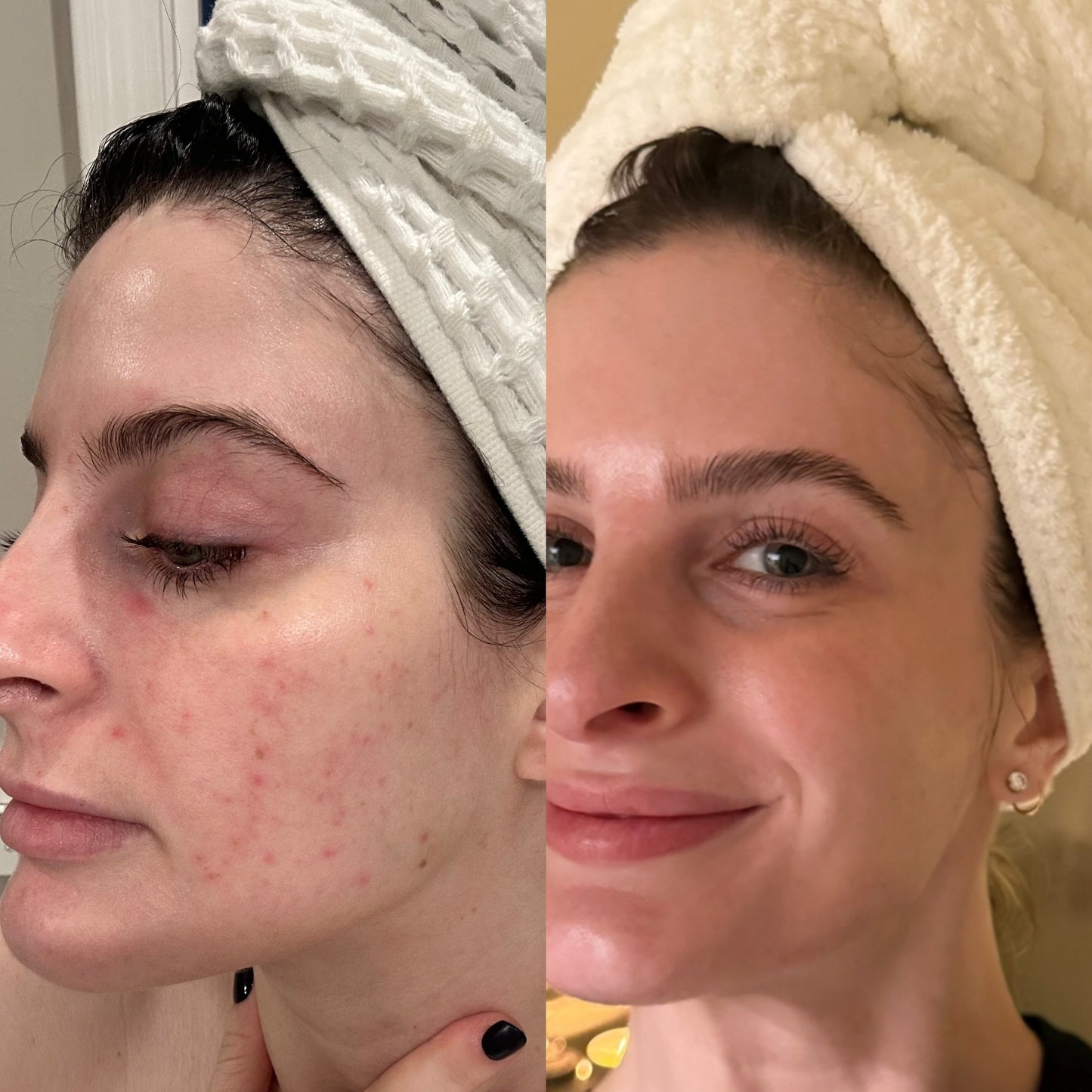 SIV Biome Balancing Serum
